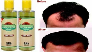 SBL Pure Jaborandi Homeopathy Hair Oil Prevents Hair Fall & Hair Growing 200ml - Picture 1 of 4