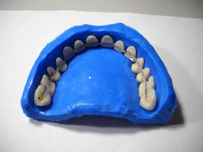 645L 热塑性假牙制作全或部分假牙 40 克 + 视频 — 第 1/4 张图片