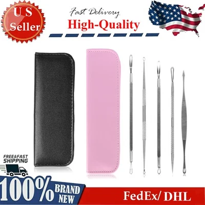 5 Pcs Stainless Steel Blackhead Remover Kit w/ Portable Bag for Effective Acne - Image 1 of 4