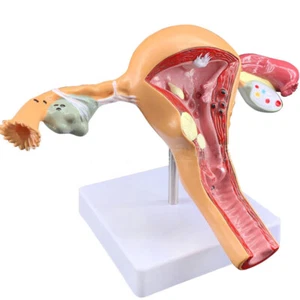 Modelo de ovario de útero patológico humano anatomía anatómica patología de enfermedades - Imagen 1 de 6