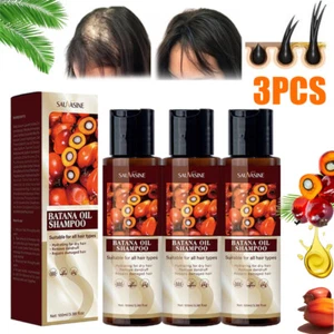 3PCS Batana Oil Shampoo For Hair Growth Healthier Thicker Fuller Anti Hair Loss - Picture 1 of 18