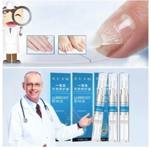 Nützlicher FORTGESCHRITTENER PILZNAGEL NATÜRLICHE REPARATUR MAGISCHER STIFT NAGELPFLEGE BEHANDLUNGSSTIFT heiß - Bild 1 von 12