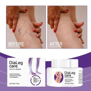 Varicose Veins Relief Cream Relieve Tired Legs Spider Pain Tighten Smooth Skin - Picture 1 of 12