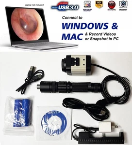 Endoscopio rígido sinuscopio otoscopio nasoscopio ENT HD USB cabezal de cámara + fuente de luz - Imagen 1 de 17