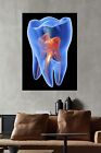 X-ray Molar Tooth, Dental Art, Dentist Art, Dental Clinic Canvas WALL ART