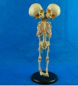 Baby Skelett mit Doppelkopf Modell Anatomie Lehrmodell Medizinische Neu DE - Bild 1 von 4