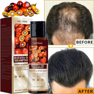 SAUVASINE Batana Oil For Hair Growth Hair Loss Treatment Pure Natural Botana Oil Shampoo