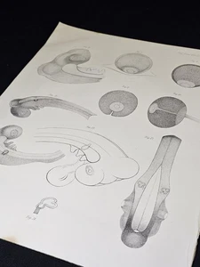 1850 HENRY GRAY On the Development Retina Optic Nerve RARE PAPER Anatomy - Picture 1 of 11