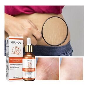 Stretch Marks Repair And Desalination  Oil Pregnant Women Lift Tightening NEW