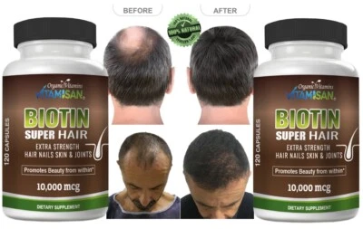 Hair Growth Vitamins Hair Loss support to Growth  240 caps GROW BOOST - Image 1 of 4