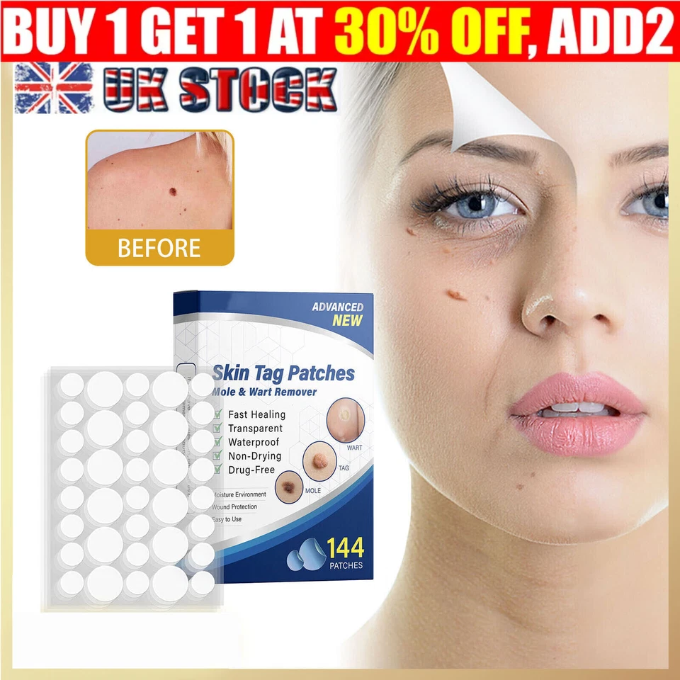 ELE_MACHAO 144pcs Skin Tag Remover Patches Quick Effective Mole Wart Removal Pad Sticker UK