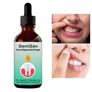 Dentizen Gum Therapy Gel, Gum Regrowth for Receding Gums, Gum Repair Regrowth - Picture 1 of 11