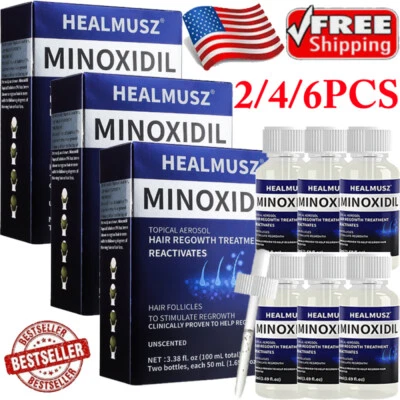 Minoxidil 5% Extra Strength For Men's Hair Regrowth Treatment 2-6 Month Supply - Image 1 of 4