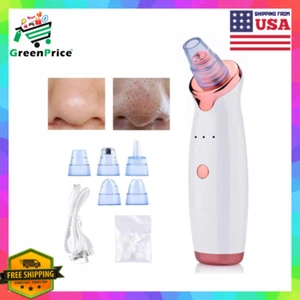 Eliminar las Espinillas Aspirador Para sacar Puntos Negros Removedor De Acne USA - Picture 1 of 12