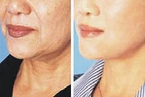 4 Day Sample to See Effect! Remove Wrinkle Anti-Ageing Concentrated Herb Powder - Picture 1 of 8