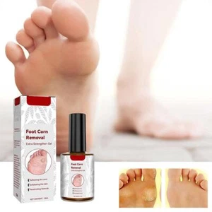 Foot Corns Exfoliating Foot Gel Warts, Spurs, Calluses W1B7 Removal Corns G6B6 - Picture 1 of 14
