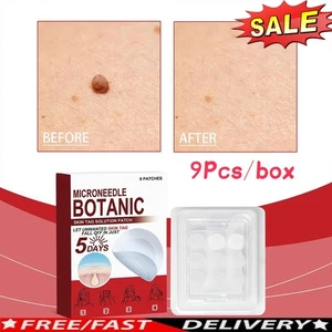 MICRONEEDLE BOTANIC Hautanhängsel & Aknepflaster Hautanhängsel Entferner Pflaster 9 Stück - Bild 1 von 17