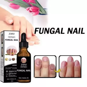 Sérum réparateur pour ongles Essence pour éliminer les mycoses des ongl. - Picture 1 of 14