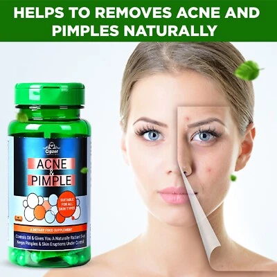 Cipzer Acne & Pimples 60 Capsule | Fights Acne, Pimples & Promotes Clear Skin - Image 1 of 4