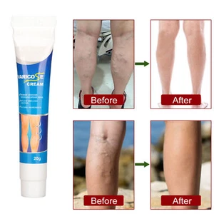 Varicose Veins Cream Strong Penetration Ingredients Gentle Leg Care Cream 20g - Picture 1 of 22