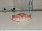 Zahnprothese,zahnersatz,prothese, oberkiefer, dental,Gebiss.