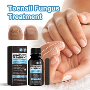 Finger Nail And Toe Nail Fungus Treatment Extra Strength 30ML Natural Treatment - Picture 1 of 14