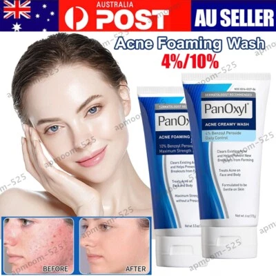 Acne Face Wash 4% /10% Benzoyl Peroxide Maximum Strength Acne Foaming Cleanser - image 1 of 4