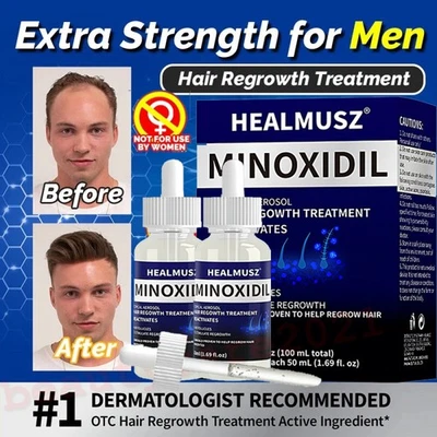 MINOXIDIL 5% Hair Regrowth Treatment FOR MEN 2 x 50ml Bottles (2 Month Supply) - Image 1 of 4