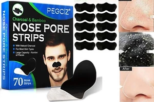 Deep Cleansing Charcoal Nose Strips | Instant Blackhead Removal Pore Exfoliator - Picture 1 of 9