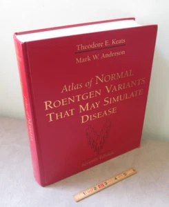 Radiologist Radiology Atlas of Normal Roentgen Variants That Simulate Disease 7 - Picture 1 of 9