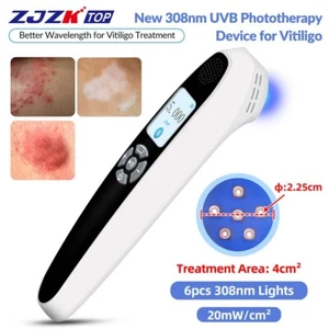 NonInvasive 308nm UV Light Therapy Lamp for Skin Diseases Scaling Depigmentation - Picture 1 of 23