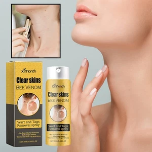 20ML Bee Venom Wart And Tags Removal Spray For Removing Moles Spots Skin Tags - Picture 1 of 14