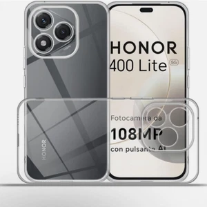 For Honor 400 Lite/200/90 Pro X8A X6B Case Slim Clear Silicone Shockproof Cover - Picture 1 of 57