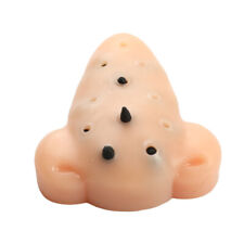 Blackhead Shape Pimple Toys Squeeze Acne Stress Relief Toys  Remover Stop T.t2