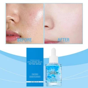 Hoygi Hyaluronic Acid Brightening Serum Lithe Moisture Improve Skin Tone. - Foto 1 di 18