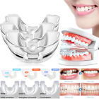 3 étapes correcteur dentaire orthodontique orthodontique accolades outil d'alignement de retenue dentaire