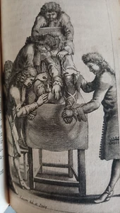 Tolet Traite de la Lithotomie Extraction Pierre Vessie urologie calcul 1686 - Picture 1 of 9
