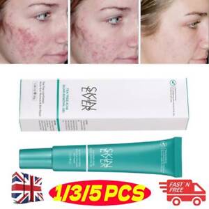 Tea Tree Acne Scar Removal Gel Acne Treatment Serum nti Inflammation Pimple UK