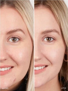 Reine Hyaluronsäure polstert Falten Feuchtigkeit Anti-Aging verschiedene Oz. - Bild 1 von 6