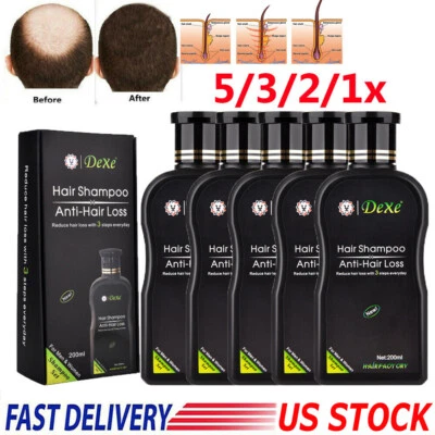 Dexe Anti Hair Loss Shampoo Natural Herbal Hair Growth Treatment Hair Regrowth - Image 1 of 4