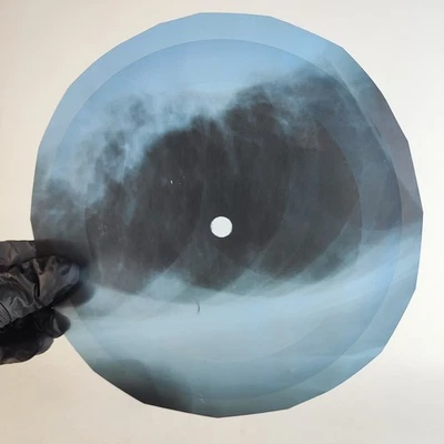 DAVID BOWIE LITTLE BOMBARDIER X-Ray USSR Record Roentgen Bone Ribs Music Vinyl - Image 1 of 2