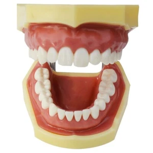 Modelo de dientes, modelo de dientes de demostración dental, estudio estándar enseñanza modo dental - Imagen 1 de 11