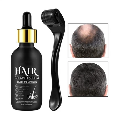 MARKENLOS 5 % Minoxidil Haarwuchs-Serumöl für Männer und Frauen, 60 ml + Derma-Roller