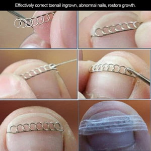 AS THE DISCRIPTION SHOWN 2 scatole correttore reclinabile filo unghie correzione unghie NUOVO