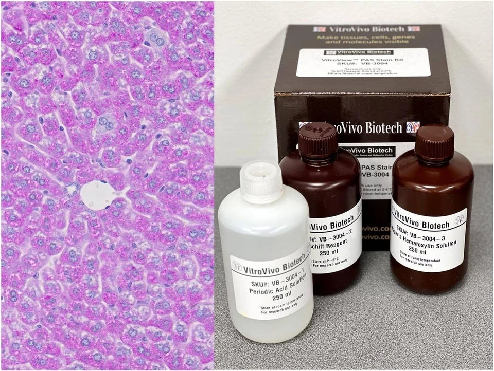 Kit de manchas VitroView™ PAS (Cat#VB-3004) Foto 1 de 4