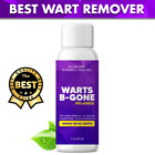 Warts-B-Gone Wart Remover- ProGrade - Wart Removal - Works on All Warts Only C$23.97 on eBay