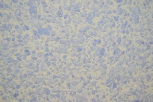 Patentierte Wandbeschichtung Flüssigtapete Baumwollputz  Relief 326 - Bild 1 von 5