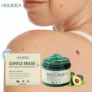 New Natureerase Instant Birthmark Spot Removal Gel 50g - Picture 1 of 20