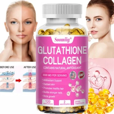 SOOMIIG Glutatión 2000mg 120 cápsulas blanqueadoras y colágeno suplemento para blanquear la piel