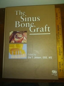 The Sinus Bone Transplantat von Ole Jensen DDS MS Hardcover 1999 - Bild 1 von 3